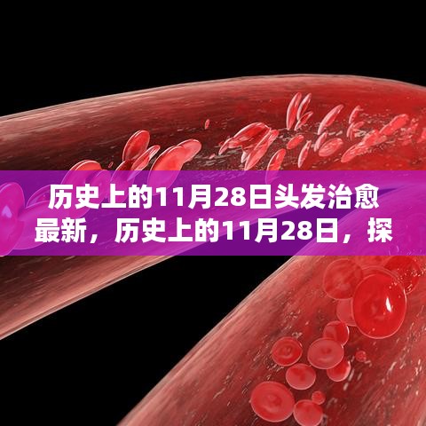 歷史上的11月28日，探尋頭發(fā)治愈的最新篇章??