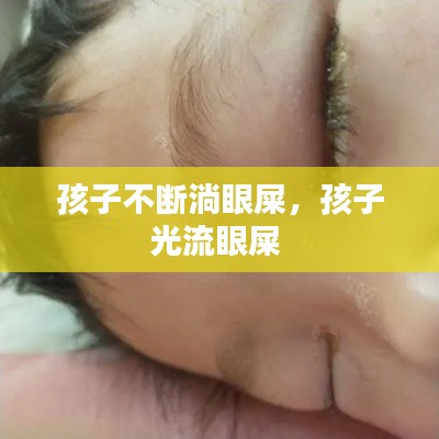 孩子不斷淌眼屎，孩子光流眼屎 