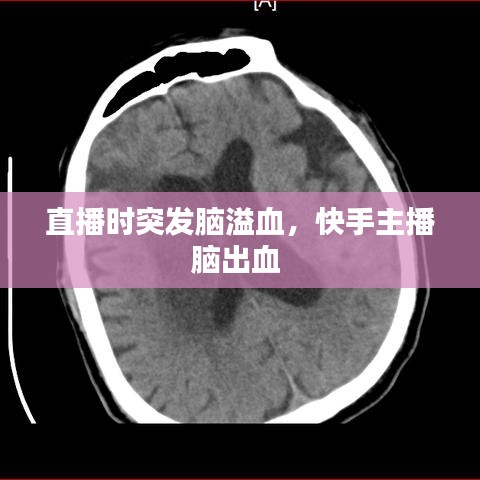 直播時(shí)突發(fā)腦溢血，快手主播腦出血 