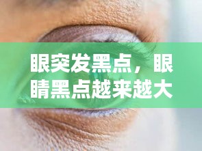 眼突發(fā)黑點(diǎn)，眼睛黑點(diǎn)越來越大 