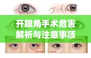 開眼角手術危害解析與注意事項指南——百度健康知識分享